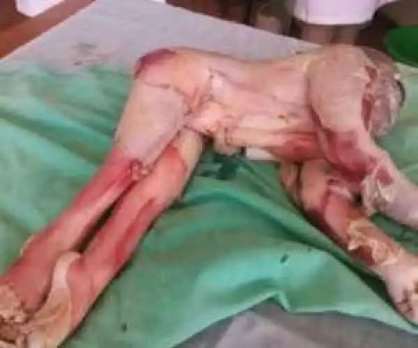 Graphic Photos: Zimbabwean Woman Gives Birth To A Strange Looking Baby 